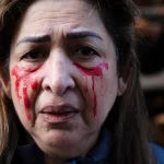 Iran: Iranian police shooting in the face to destroy the beauty of protesting women, doctors revealed