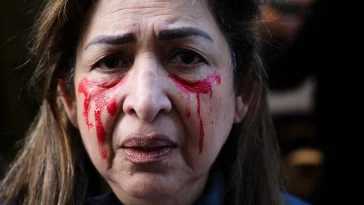 Iran: Iranian police shooting in the face to destroy the beauty of protesting women, doctors revealed