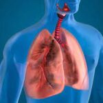Treat Air pollution related lung disease naturally