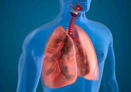 Treat Air pollution related lung disease naturally