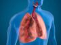 Treat Air pollution related lung disease naturally