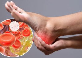 5 foods to reduce bad cholesterol levels