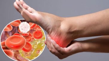 5 foods to reduce bad cholesterol levels