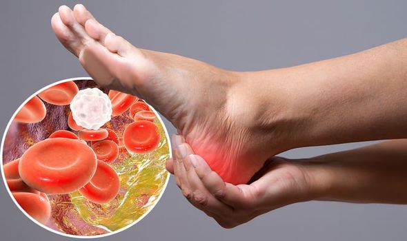 5 foods to reduce bad cholesterol levels