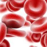 iron deficiency anemia