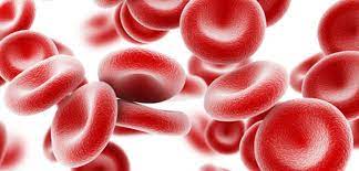iron deficiency anemia