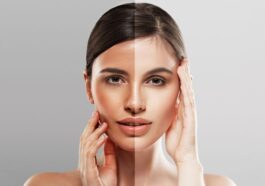 How to Reverse Sun Tan: Regain Your Natural Glow