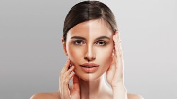 How to Reverse Sun Tan: Regain Your Natural Glow