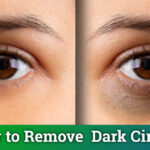 dark circles home remedies dark circles natural treatment home remedies home remedies for dark circles treat dark circles naturally