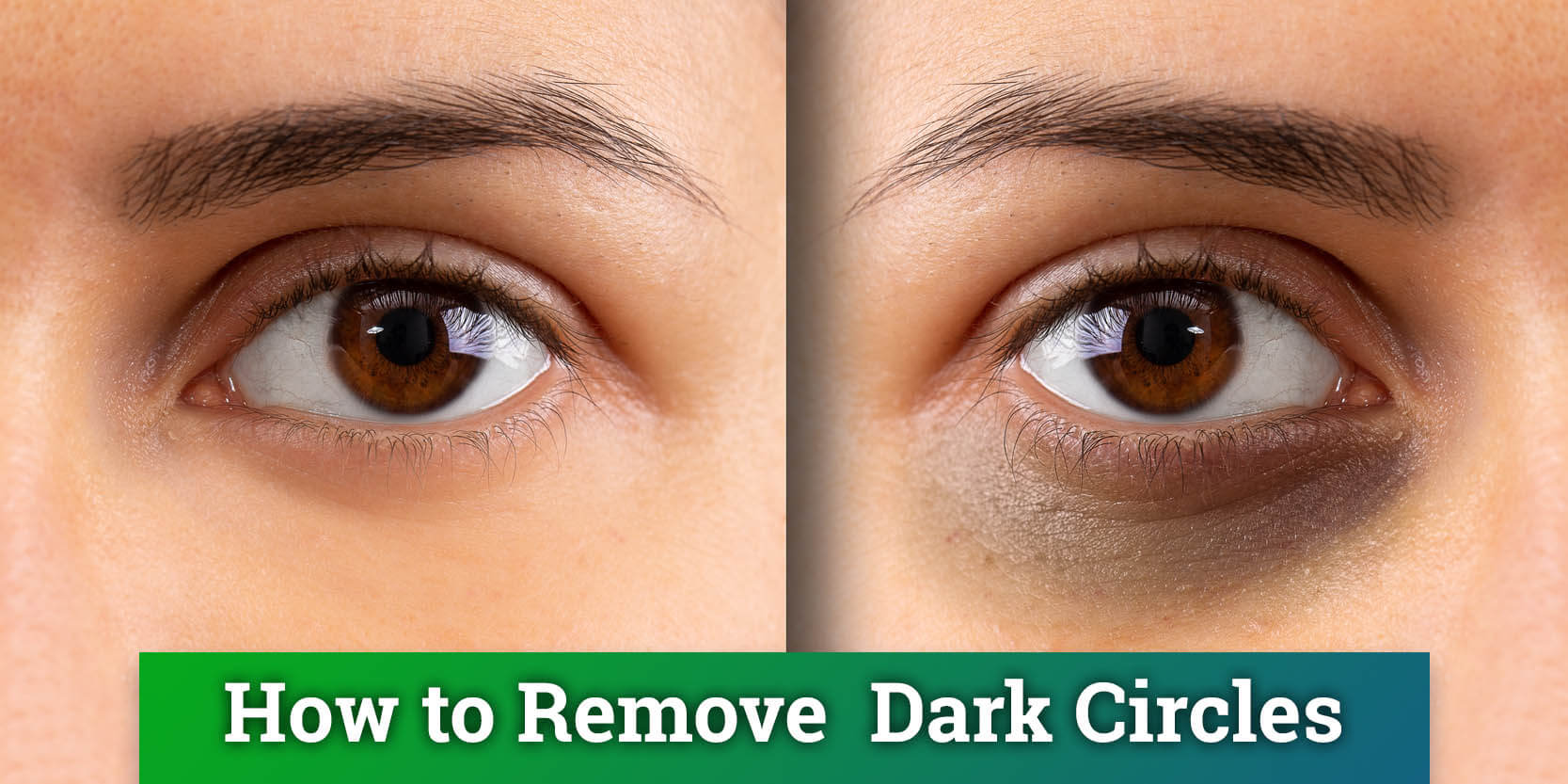 dark circles home remedies dark circles natural treatment home remedies home remedies for dark circles treat dark circles naturally