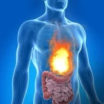 home-remedies-for-acidity