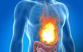 home-remedies-for-acidity