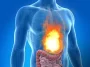 home-remedies-for-acidity