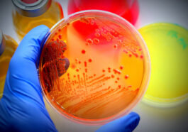 Microbiology: The study of life's smallest creatures