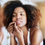 acne" "effective ways to treat acne" "Health" "home hacks for acne" "home remedies" "home remedies to get ride of acne" "home tricks to treat acne" "how is acne treated"