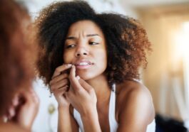 acne" "effective ways to treat acne" "Health" "home hacks for acne" "home remedies" "home remedies to get ride of acne" "home tricks to treat acne" "how is acne treated"