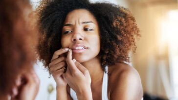 acne" "effective ways to treat acne" "Health" "home hacks for acne" "home remedies" "home remedies to get ride of acne" "home tricks to treat acne" "how is acne treated"