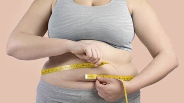 What’s Treatment for Obesity Like?