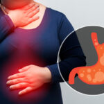 Solution of Stomach Problem