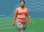 Understanding Morbid Obesity